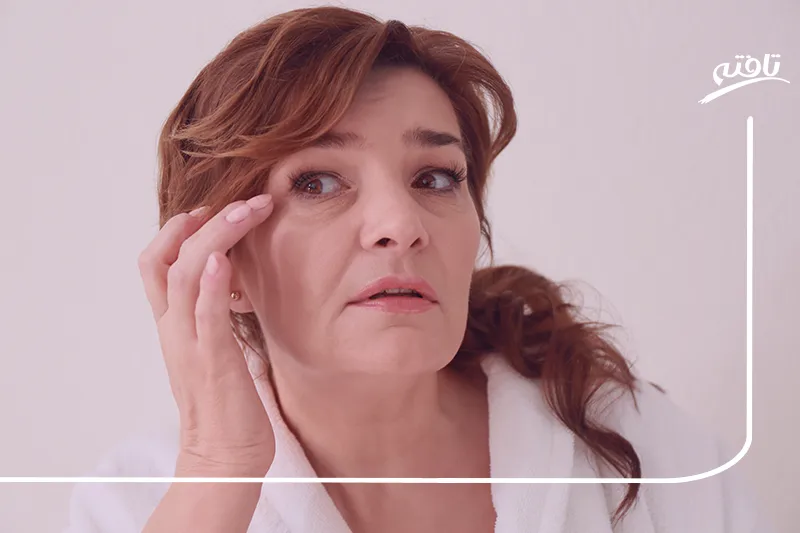 علت پف زیر چشم بانوان