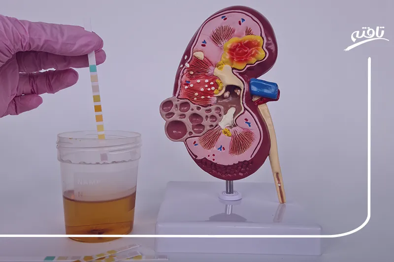 ادرار خونی در زنان